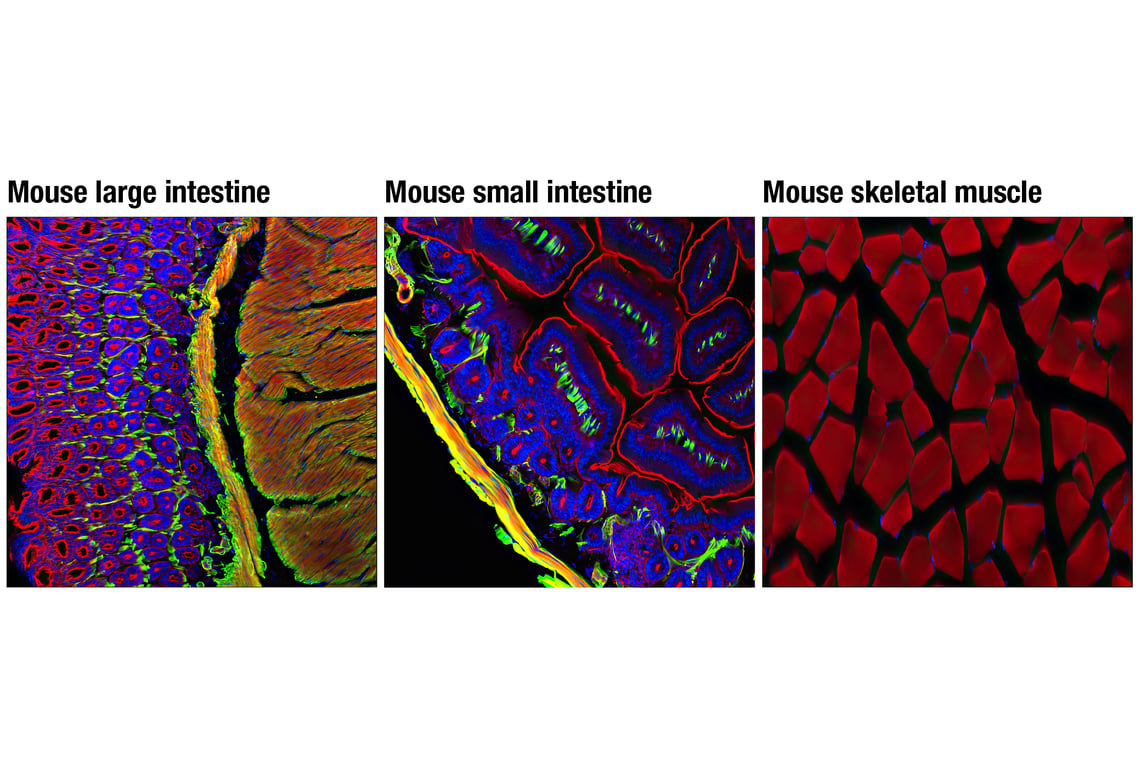 アレルギー α-Smooth Muscle Actin (D4K9N) XP® Rabbit mAb (Alexa Fluor