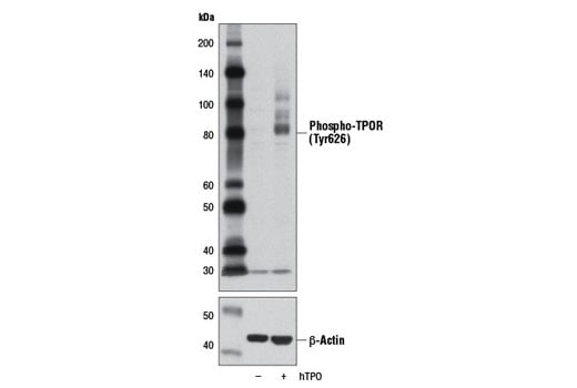 Western Blotting Image 2: Phospho-TPOR (Tyr626) (D3H7B) Rabbit Monoclonal Antibody