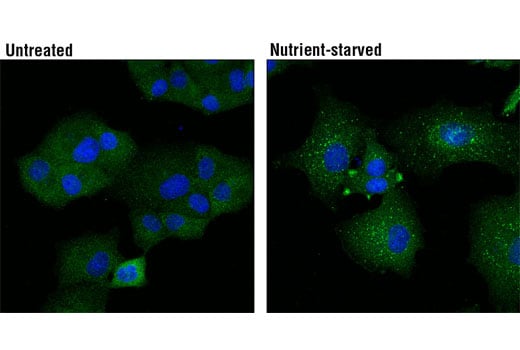 Immunofluorescence Image 1: Atg13 (E1Y9V) Rabbit Monoclonal Antibody (BSA and Azide Free)