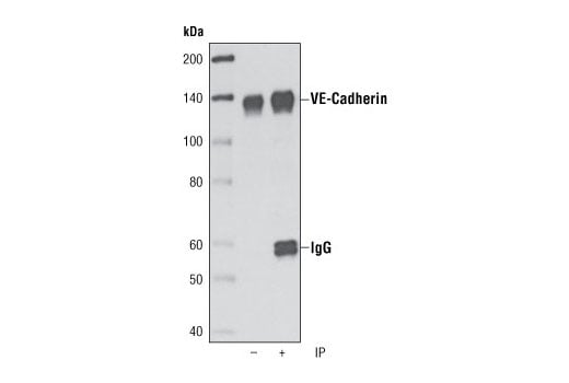 Immunoprecipitation Image 1: VE-Cadherin (D87F2) Rabbit Monoclonal Antibody