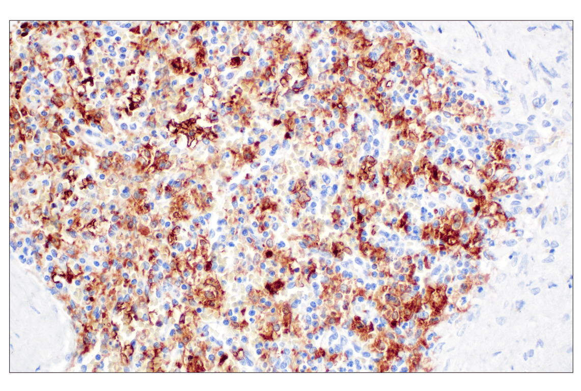 Immunohistochemistry Image 7: FTL (F9O4I) Rabbit Monoclonal Antibody