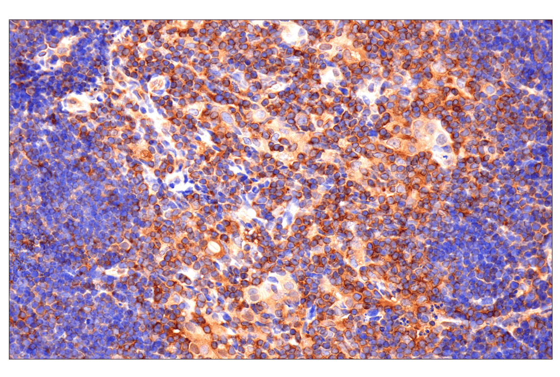 Immunohistochemistry Image 8: Caspase-8 (F5K9P) Rabbit Monoclonal Antibody