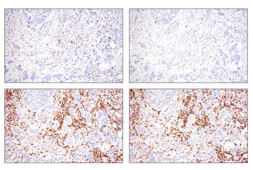 Immunohistochemistry Image 1: Phospho-SLP-76 (Ser376) (E3G9U) Rabbit Monoclonal Antibody