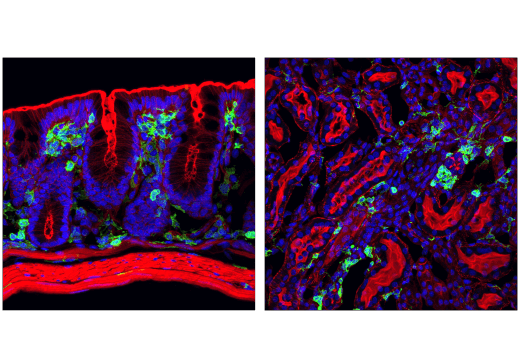 BTS CD16種類！ CD45 (D3F8Q) Rabbit mAb | Cell Signaling Technology
