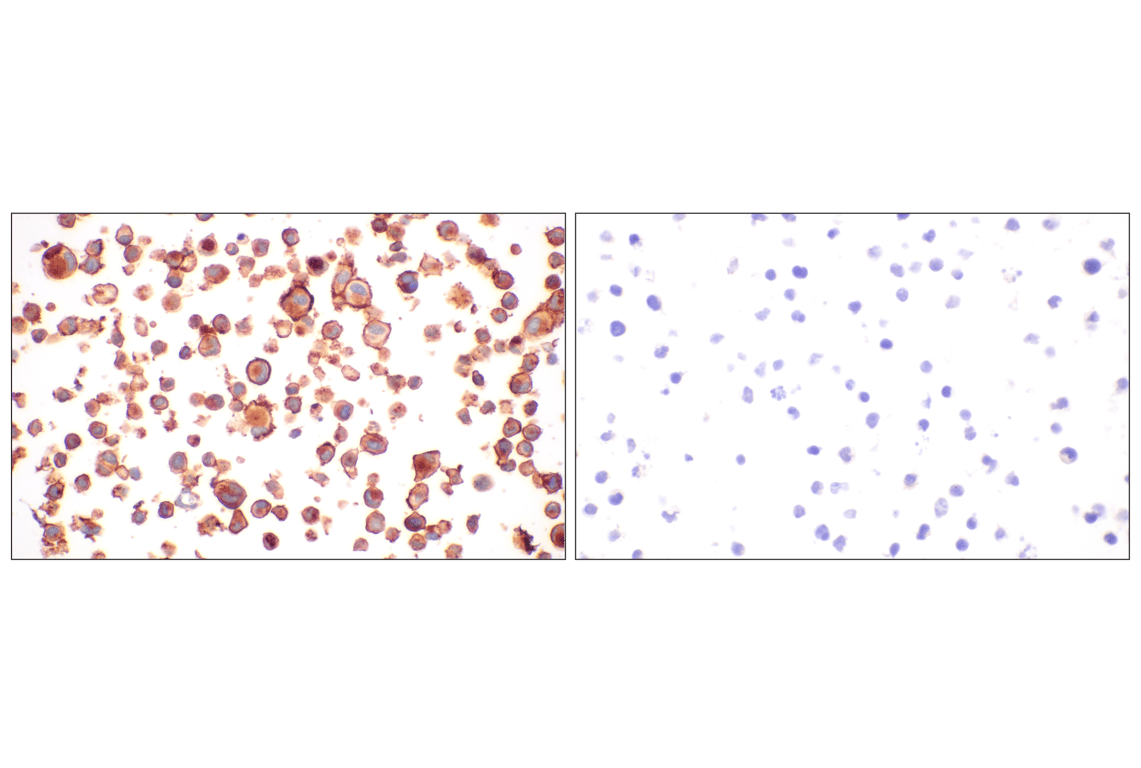 Immunohistochemistry Image 11: CD58 (F1C9B) Rabbit Monoclonal Antibody