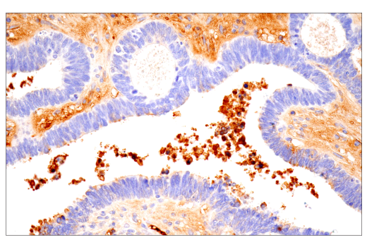 Immunohistochemistry Image 2: IgA (N1CLA) Mouse Monoclonal Antibody