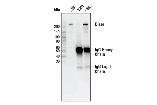 Immunoprecipitation Image 1: Dicer (D38E7) Rabbit Monoclonal Antibody