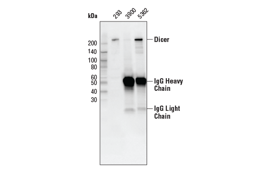 undefined Image 9: RNAi Machinery Antibody Sampler Kit