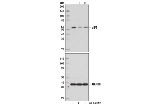 Western Blotting Image 2: eIF5 (D5G9) Rabbit Monoclonal Antibody