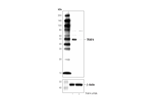 Western Blotting Image 3: TRAF4 (D1N3A) Rabbit Monoclonal Antibody