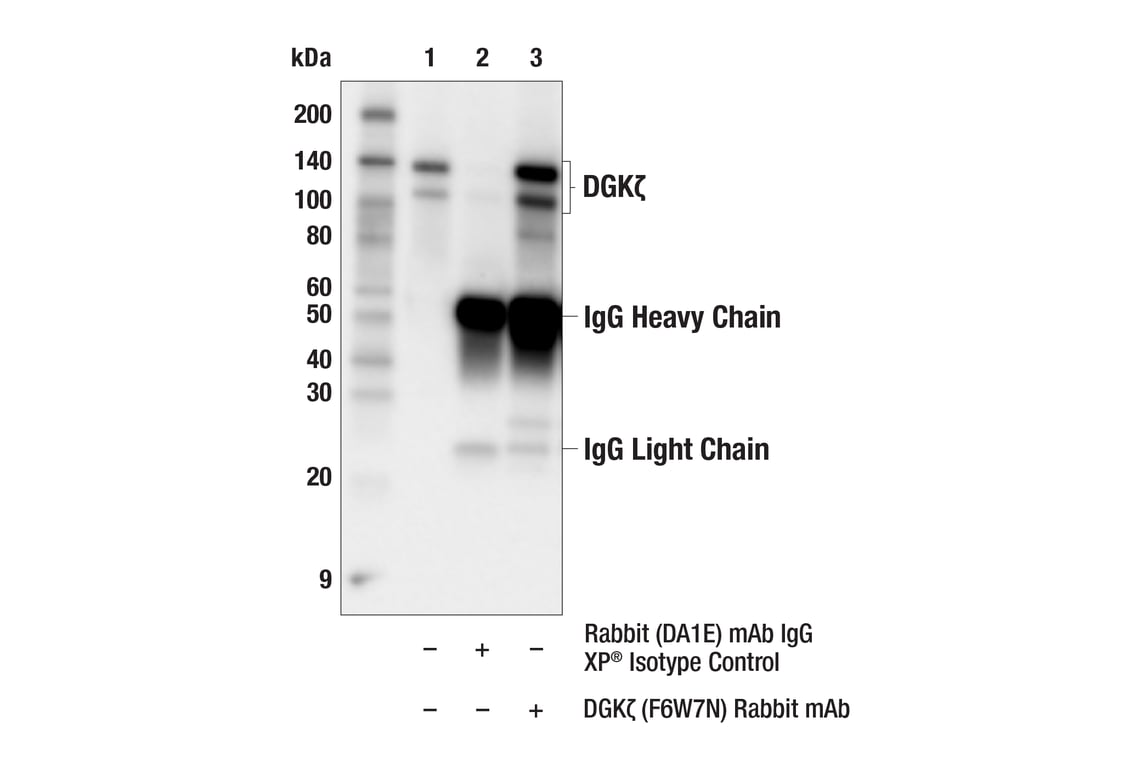 Immunoprecipitation Image 1: DGK zeta (F6W7N) Rabbit Monoclonal Antibody