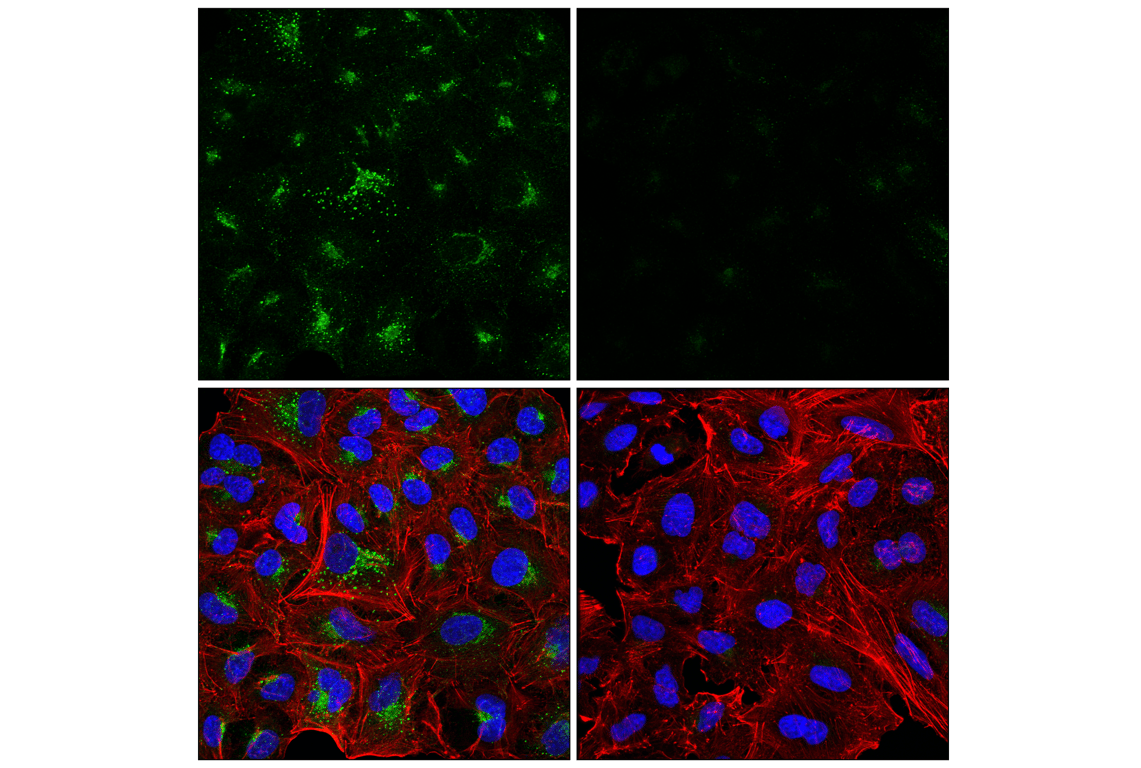 Immunofluorescence Image 1: APP (E8B3O) Rabbit Monoclonal Antibody