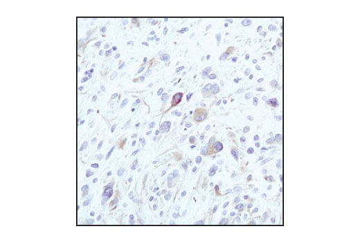 Immunohistochemistry Image 1: beta-Tubulin (9F3) Rabbit Monoclonal Antibody (BSA and Azide Free)