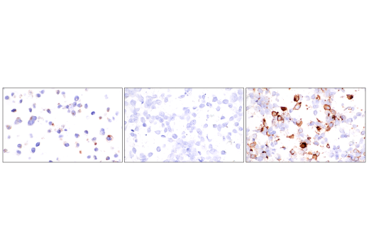 Immunohistochemistry Image 11: CTLA-4 (E2V1Z) Rabbit mAb (BSA and Azide Free)