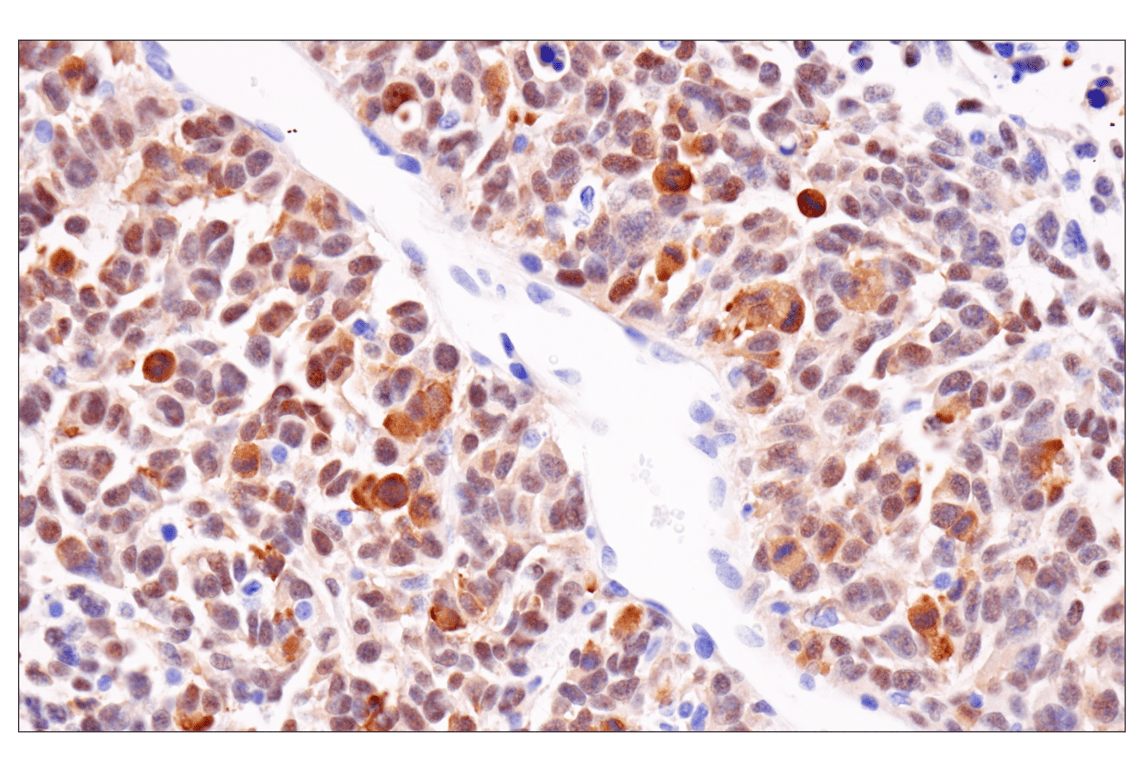 Immunohistochemistry Image 2: p19 ARF (F6F7N) Rabbit Monoclonal Antibody