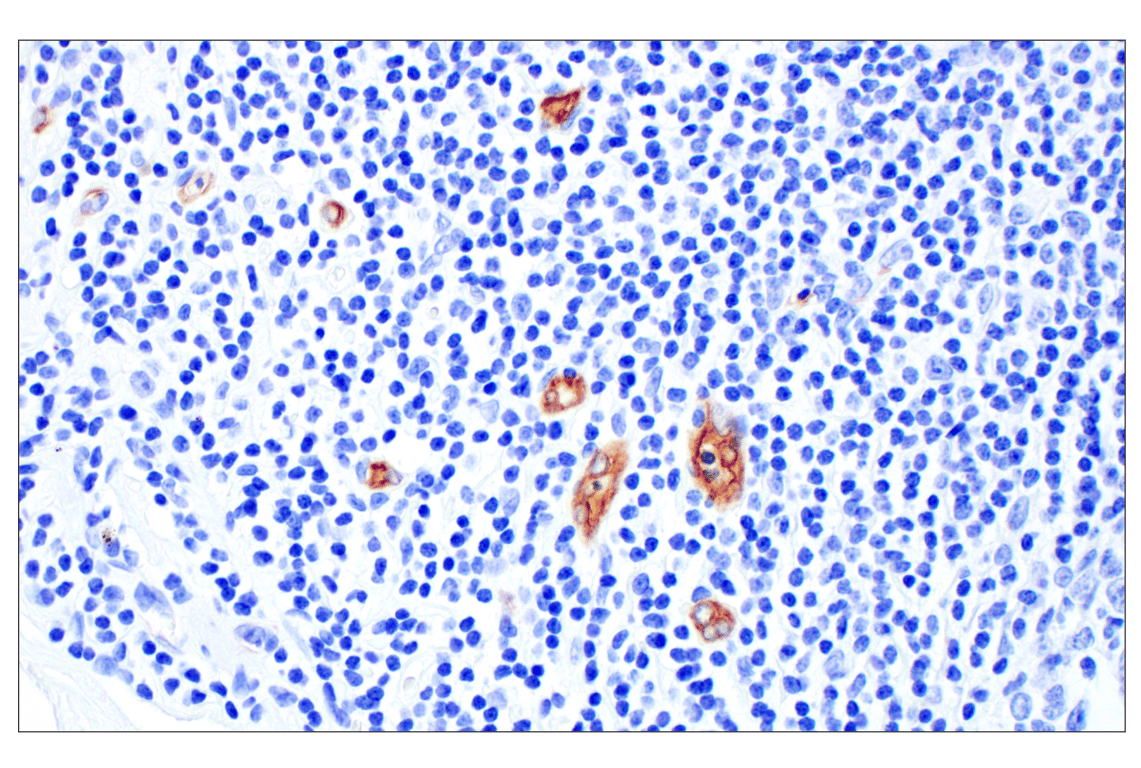 Immunohistochemistry Image 5: MAdCAM-1 (E1V8F) Rabbit Monoclonal Antibody (BSA and Azide Free)