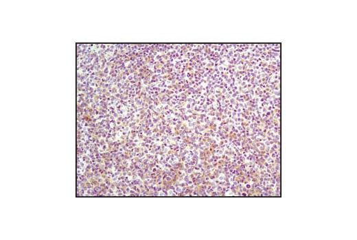 Immunohistochemistry Image 2: Lck (D88) Rabbit Monoclonal Antibody