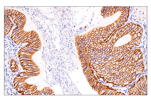Immunohistochemistry Image 7: NCAM1 (CD56) (E7X9M) XP<sup>®</sup> Rabbit mAb