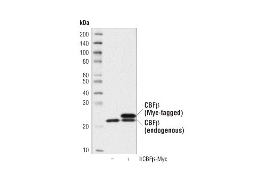 Western Blotting Image 2: CBF beta (D4N2N) Rabbit Monoclonal Antibody