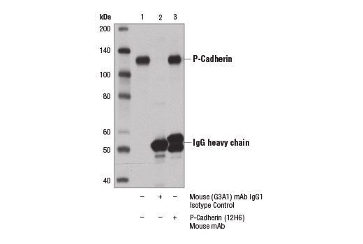 Immunoprecipitation Image 1: P-Cadherin (12H6) Mouse Monoclonal Antibody