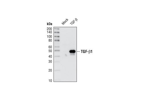 Western Blotting Image 2: TGF-beta (56E4) Rabbit Monoclonal Antibody