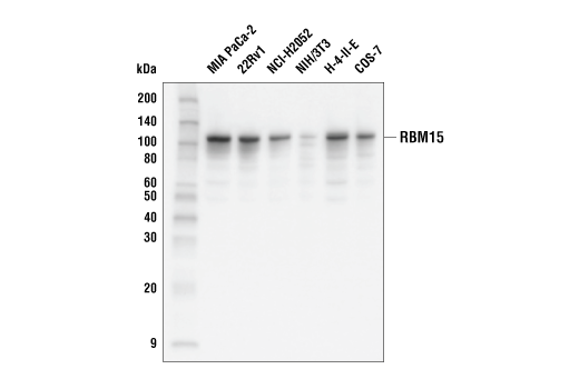 Western Blotting Image 1: RBM15 (E8Y8A) Rabbit mAb