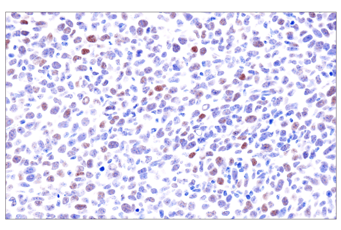 Immunohistochemistry Image 16: GATA-6 (D61E4) XP<sup>®</sup> Rabbit mAb (BSA and Azide Free)