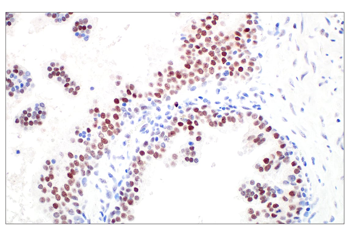 Immunohistochemistry Image 3: GATA-2 (E8B5C) Rabbit Monoclonal Antibody (BSA and Azide Free)