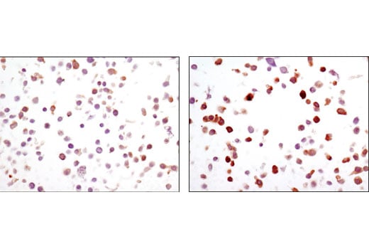 undefined Image 28: Angiogenesis Antibody Sampler Kit