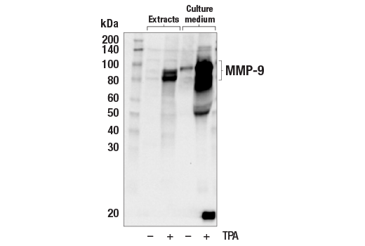 Western Blotting Image 2: MMP-9 (D6O3H) Rabbit Monoclonal Antibody (Biotinylated)