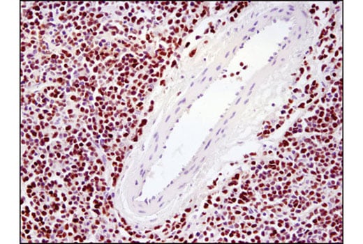 Immunohistochemistry Image 3: Ezh2 (D2C9) Rabbit Monoclonal Antibody (BSA and Azide Free)
