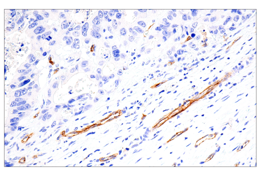 Immunohistochemistry Image 5: IL3RA/CD123 (BR4MS) Mouse Monoclonal Antibody