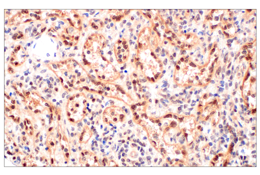 Immunohistochemistry Image 7: CRBN (D8H3S) Rabbit Monoclonal Antibody (BSA and Azide Free)