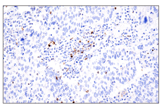 Immunohistochemistry Image 2: Phospho-SLP-76 (Ser376) (E3G9U) Rabbit Monoclonal Antibody