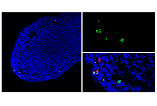 Immunofluorescence Image 1: TUNEL Assay Kit (Fluorescence, 488 nm)
