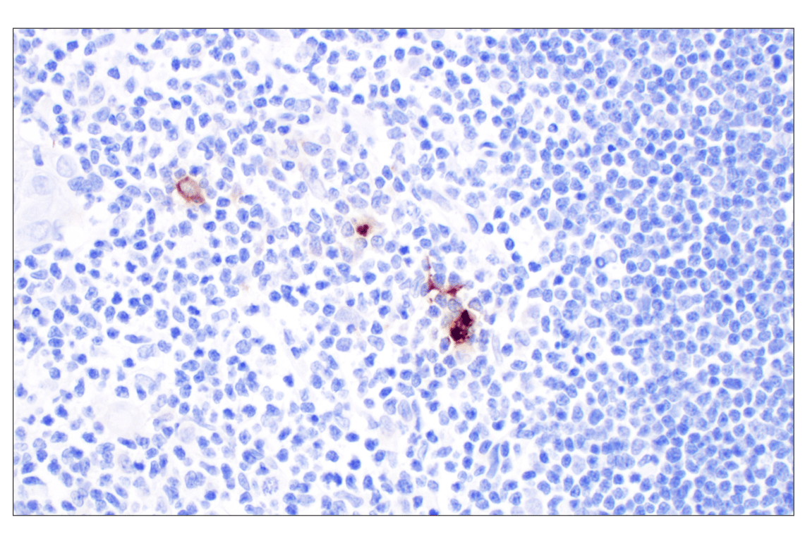 Immunohistochemistry Image 3: CXCL10 (F9N8I) Rabbit Monoclonal Antibody
