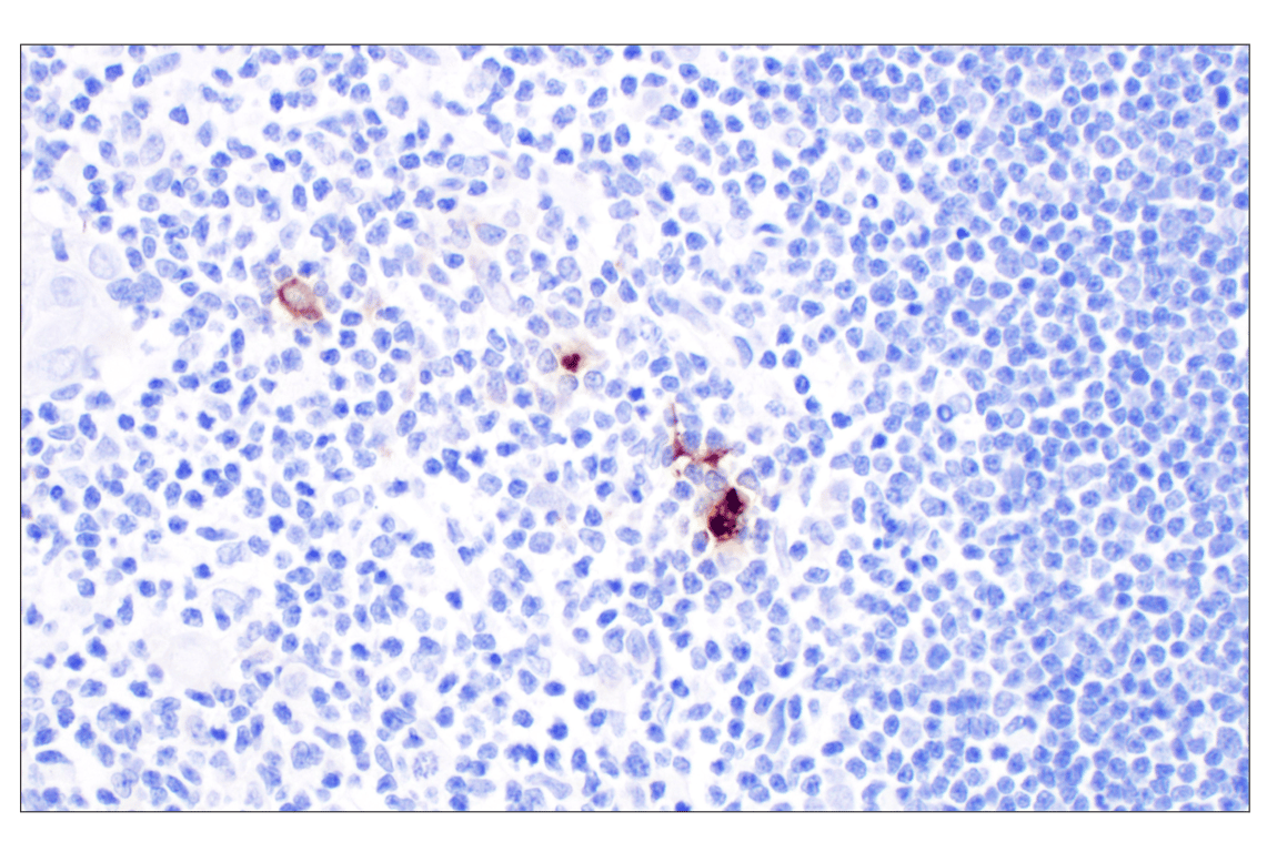 Immunohistochemistry Image 3: CXCL10 (F9N8I) Rabbit mAb
