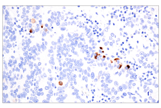 Immunohistochemistry Image 3: TIMP1 (D10E6) Rabbit Monoclonal Antibody