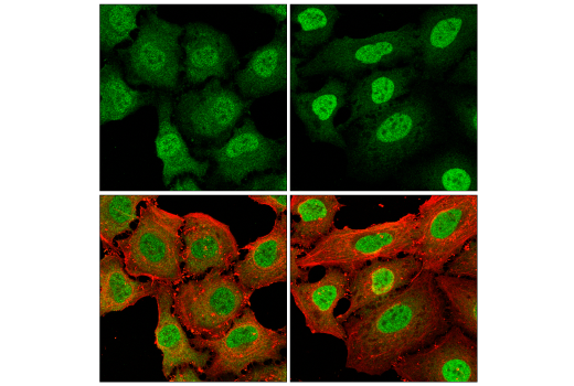 Immunofluorescence Image 1: Stat1 (D4Y6Z) Rabbit mAb (BSA and Azide Free)