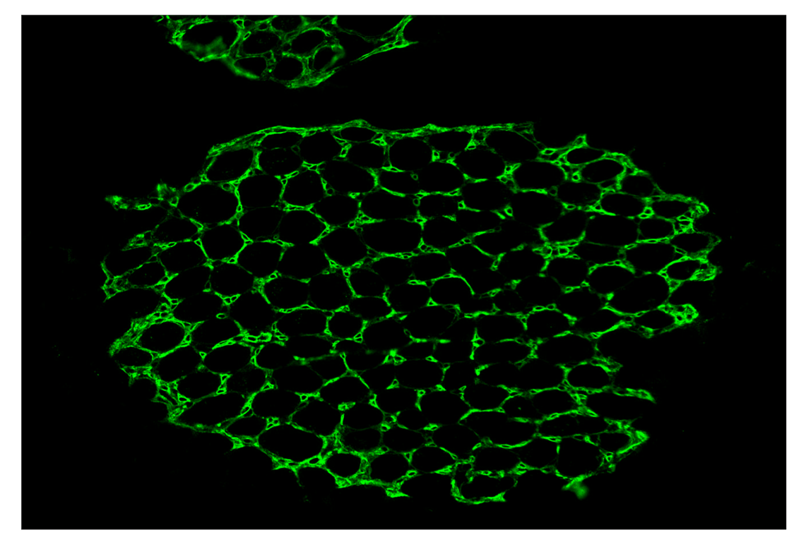 Immunohistochemistry Image 2: CD39/NTPDase 1 (E2X6B) & CO-0076-647 SignalStar<sup>™</sup> Oligo-Antibody Pair
