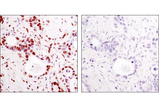Immunohistochemistry Image 1: Acetyl-Histone H3 (Lys9) (C5B11) Rabbit Monoclonal Antibody