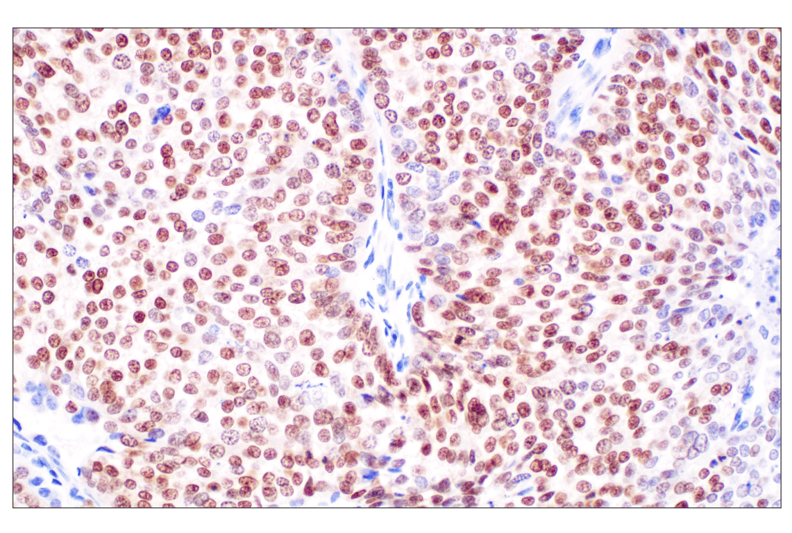 Immunohistochemistry Image 4: Sox10 (E2V9N) Rabbit Monoclonal Antibody (BSA and Azide Free)