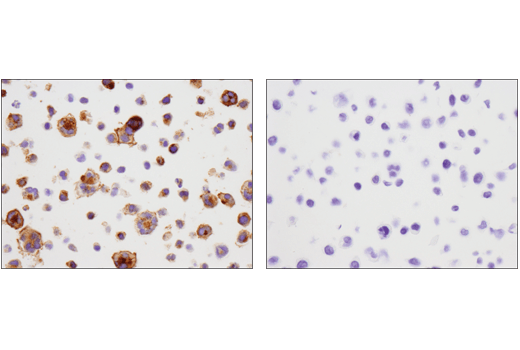 Immunohistochemistry Image 3: 4-1BB/CD137/TNFRSF9 (D2Z4Y) Rabbit Monoclonal Antibody