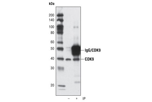Immunoprecipitation Image 1: CDK9 (C12F7) Rabbit Monoclonal Antibody