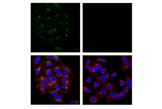 Immunofluorescence Image 1: APP (E5X2B) Rabbit Monoclonal Antibody