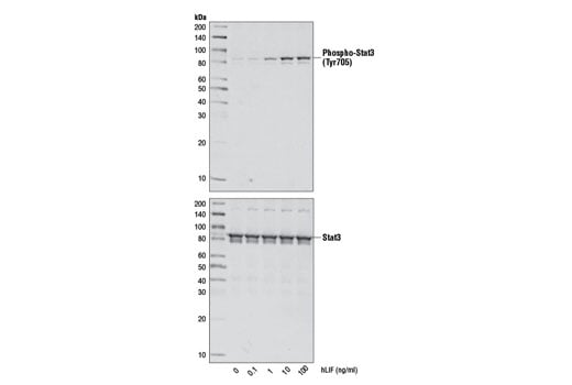 undefined Image 3: Human Leukemia Inhibitory Factor (hLIF)
