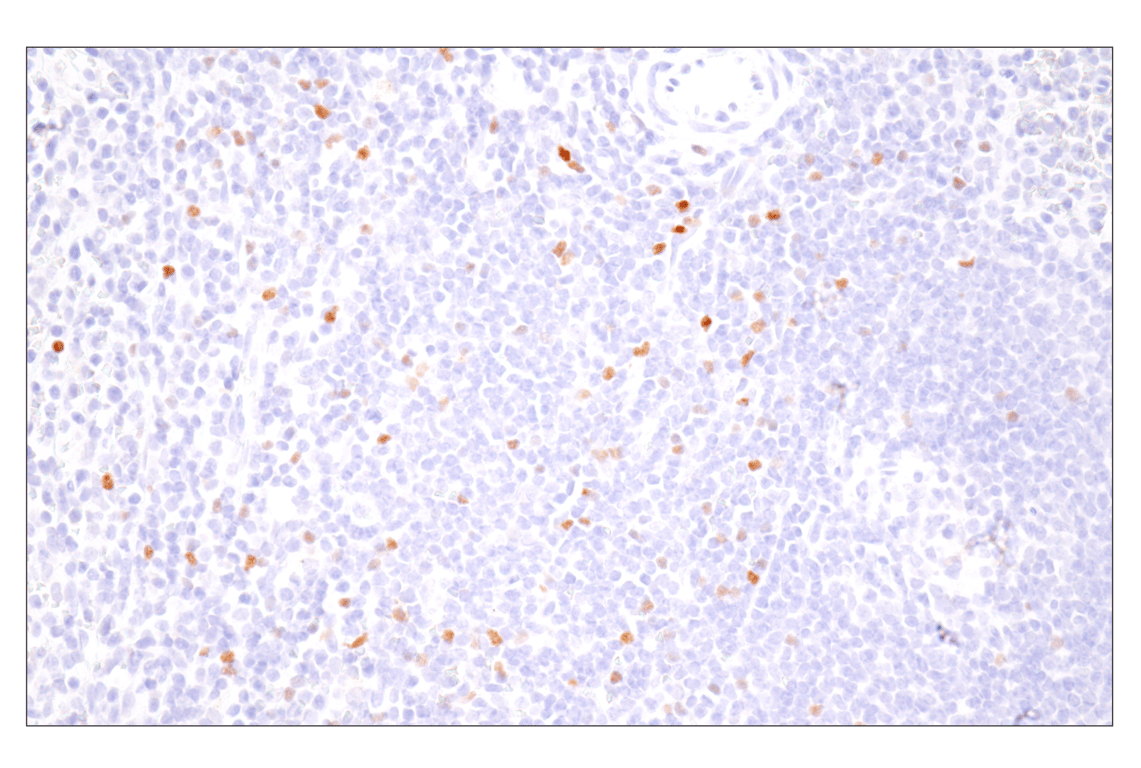 Immunohistochemistry Image 3: FoxP3 (D2W8E) Rabbit Monoclonal Antibody (BSA and Azide Free)