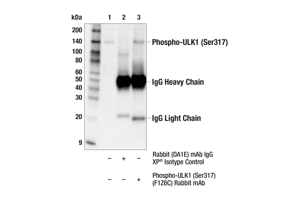 Immunoprecipitation Image 1: Phospho-ULK1 (Ser317) (F1Z6C) Rabbit Monoclonal Antibody