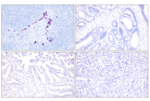 Immunohistochemistry Image 2: PMEL/Melanoma gp100 (HMB45) Mouse Monoclonal Antibody