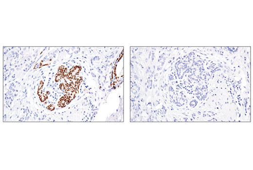 Immunohistochemistry Image 3: Sox10 (E6B6I) Rabbit Monoclonal Antibody (BSA and Azide Free)